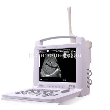 Laptop Portable Ultrasound Scanner Harga Mesin Ultrasound